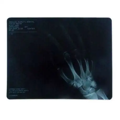 Tapis de souris informatique radiographie main